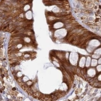 Immunohistochemical staining of human colon using Anti-APOBR antibody HPA042093.