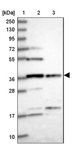 Lane 1: Marker [kDa] 250, 130, 95, 72, 55, 36, 28, 17, 10_br/_Lane 2: Human cell line RT-4_br/_Lane 3: Human cell line U-251MG sp