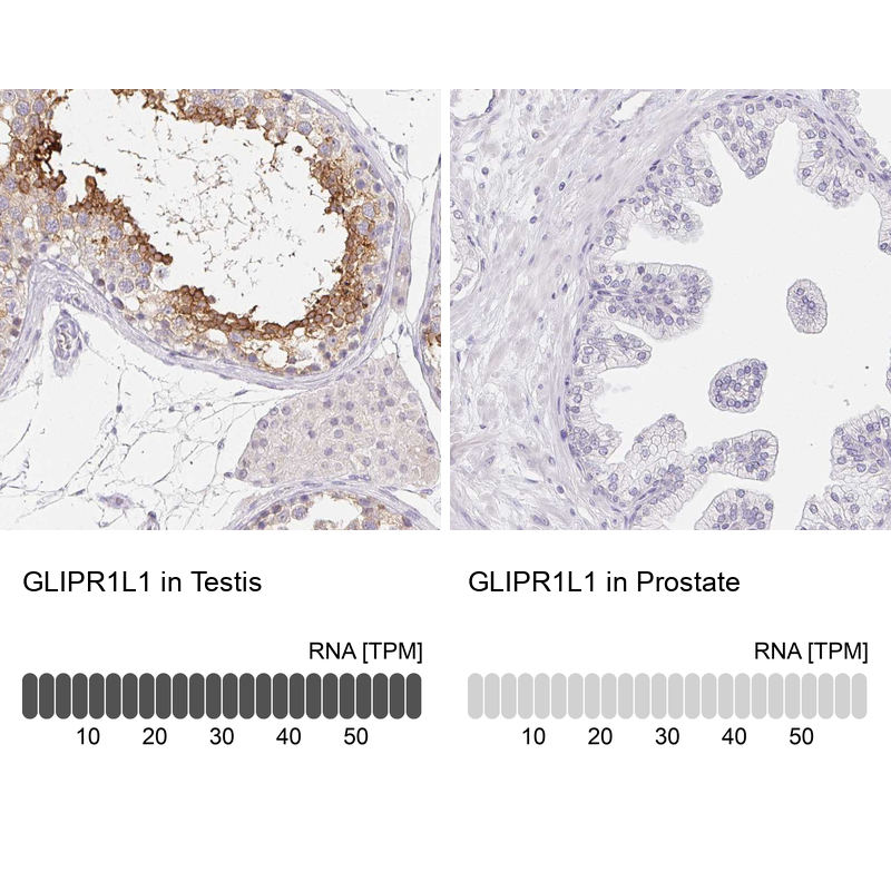 Anti-GLIPR1L1 Antibody