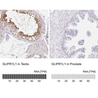 Anti-GLIPR1L1 Antibody
