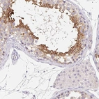 Immunohistochemical staining of human testis shows high expression.