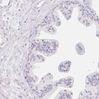 Immunohistochemical staining of human prostate shows low expression as expected.