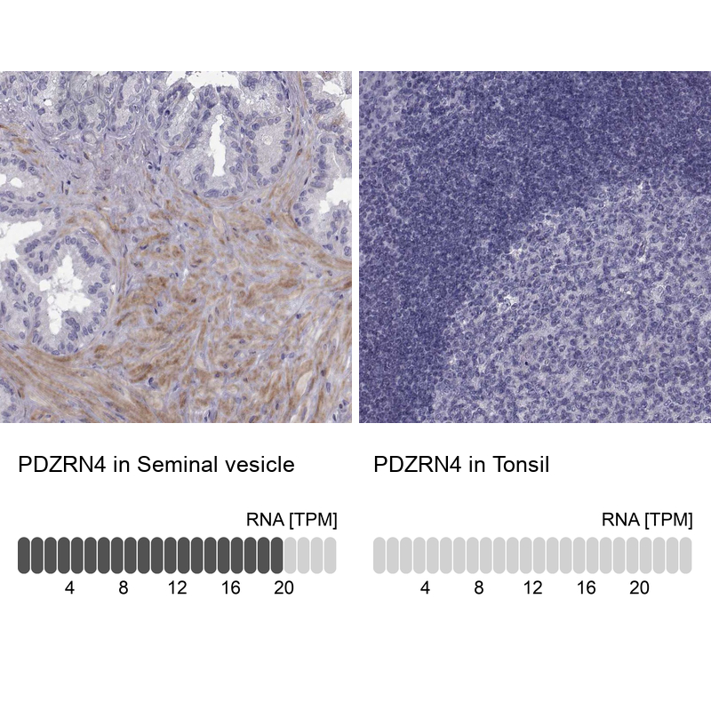 Anti-PDZRN4 Antibody