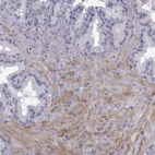 Immunohistochemical staining of human seminal vesicle shows high expression.