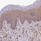 Immunohistochemical staining of human skin shows moderate to strong cytoplasmic positivity in keratinocytes.