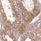 Immunohistochemical staining of human testis shows moderate to strong positivity in extracellular space in seminiferous ducts.