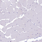 Immunohistochemical staining of human skeletal muscle shows no positivity in myocytes as expected.