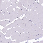 Immunohistochemical staining of human skeletal muscle shows no positivity in myocytes as expected.