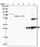 Lane 1: Marker [kDa] 250, 130, 95, 72, 55, 36, 28, 17, 10_br/_Lane 2: Human cell line RT-4_br/_Lane 3: Human cell line U-251 MG_br/_Lane 4: Human plasma_br/_Lane 5: Human Liver tissue_br/_Lane 6: Human Tonsil tissue