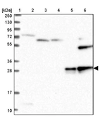 Lane 1: Marker [kDa] 250, 130, 95, 72, 55, 36, 28, 17, 10_br/_Lane 2: Human cell line RT-4_br/_Lane 3: Human cell line U-251 MG_br/_Lane 4: Human plasma_br/_Lane 5: Human Liver tissue_br/_Lane 6: Human Tonsil tissue