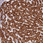 Anti-LGI4 Antibody