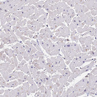 Immunohistochemical staining of human heart muscle shows no positivity in cardiomyocytes as expected.