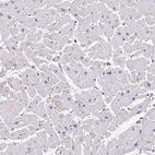 Immunohistochemical staining of human heart muscle shows no positivity in cardiomyocytes as expected.