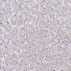 Immunohistochemical staining of human liver shows no positivity in hepatocytes as expected.