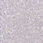 Immunohistochemical staining of human liver shows no positivity in hepatocytes as expected.