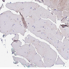 Immunohistochemical staining of human skeletal muscle shows no positivity in myocytes as expected.