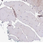 Immunohistochemical staining of human skeletal muscle shows no positivity in myocytes as expected.