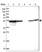 Lane 1: Marker [kDa] 250, 130, 95, 72, 55, 36, 28, 17, 10_br/_Lane 2: Human cell line RT-4_br/_Lane 3: Human cell line U-251 MG_br/_Lane 4: Human plasma_br/_Lane 5: Human Liver tissue_br/_Lane 6: Human Tonsil tissue