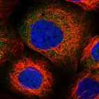 Immunofluorescent staining of human cell line A-431 shows localization to cytosol.