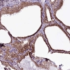 Anti-RSBN1 Antibody