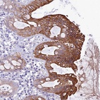 Anti-QSOX1 Antibody