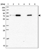 Lane 1: Marker [kDa] 250, 130, 95, 72, 55, 36, 28, 17, 10_br/_Lane 2: Human cell line RT-4_br/_Lane 3: Human cell line U-251 MG_br/_Lane 4: Human plasma_br/_Lane 5: Human Liver tissue_br/_Lane 6: Human Tonsil tissue