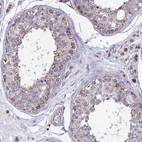 Immunohistochemical staining of human testis shows low expression as expected.