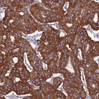 Immunohistochemical staining of human parathyroid gland shows high expression.