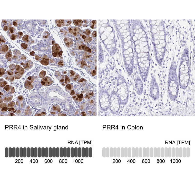 Anti-PRR4 Antibody