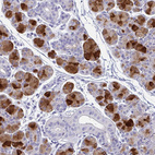 Immunohistochemical staining of human salivary gland shows moderate to strong cytoplasmic positivity in glandular cells.