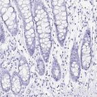 Immunohistochemical staining of human colon shows no cytoplasmic positivity in glandular cells as expected.