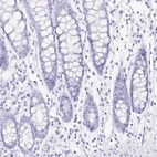 Immunohistochemical staining of human colon shows no cytoplasmic positivity in glandular cells as expected.