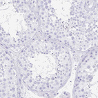 Immunohistochemical staining of human testis shows no positivity in cells in seminiferous ducts as expected.