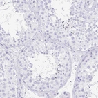 Immunohistochemical staining of human testis shows no positivity in cells in seminiferous ducts as expected.