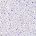 Immunohistochemical staining of human liver shows no positivity in hepatocytes as expected.