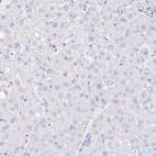 Immunohistochemical staining of human liver shows no positivity in hepatocytes as expected.