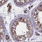 Anti-SLC39A3 Antibody