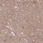 Anti-GNAI1 Antibody