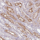 Immunohistochemical staining of human kidney shows strong membranous-cytoplasmic positivity in cells in tubules.