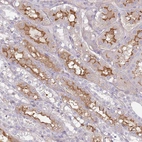 Immunohistochemical staining of human kidney shows strong membranous-cytoplasmic positivity in cells in tubules.