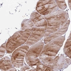 Immunohistochemical staining of human skeletal muscle shows moderate cytoplasmic positivity in myocytes.