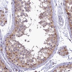 Anti-IZUMO2 Antibody