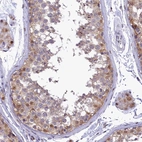 Anti-IZUMO2 Antibody