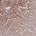 Anti-SLC25A15 Antibody