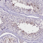 Immunohistochemical staining of human testis shows strong nuclear positivity in cells in a subset of cells in seminiferous ducts.