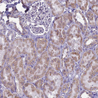 Immunohistochemical staining of human kidney shows moderate cytoplasmic-membranous positivity in cells in tubules.