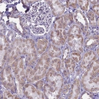 Immunohistochemical staining of human kidney shows moderate cytoplasmic-membranous positivity in cells in tubules.