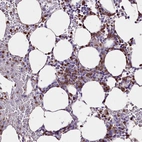 Immunohistochemical staining of human bone marrow shows strong nuclear positivity in hematopoietic cells.