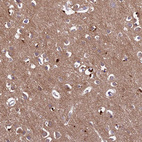 Immunohistochemical staining of human cerebral cortex shows moderate cytoplasmic-membranous positivity in glial cells and cytoplasmic positivity in neuropil and neurons.