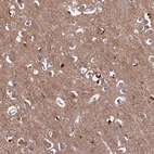 Immunohistochemical staining of human cerebral cortex shows moderate cytoplasmic-membranous positivity in glial cells and cytoplasmic positivity in neuropil and neurons.